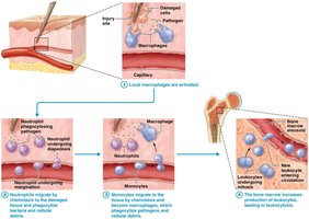 Inflammatory response, part 2