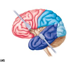 Lobes and sulci, insula location
