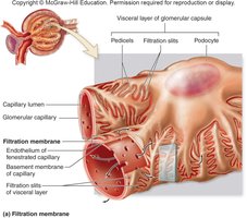 Filtration membrane structure
