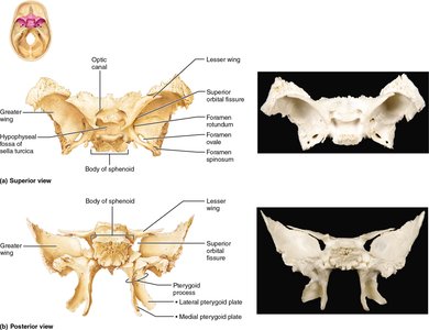 Superior and posterior views of the sphenoid bone