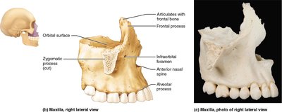 Lateral view of the maxilla showing major features