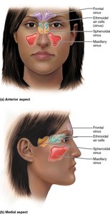 Anterior and medial aspects showing locations of paranasal sinuses