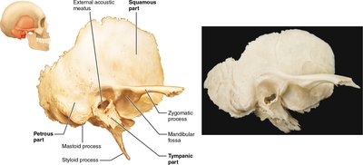 Lateral view of the temporal bone showing major features