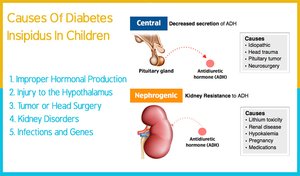 Causes of diabetes insipidus