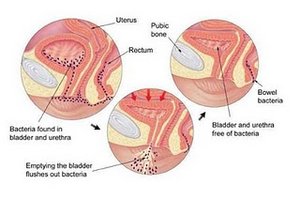 Glomerulonephritis microscopy