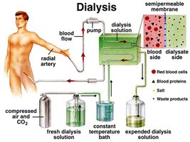 Dialysis process