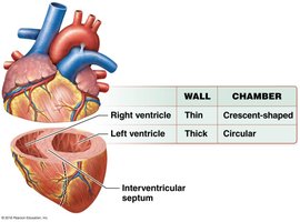 Ventricular wall thickness comparison