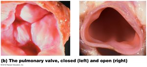 Pulmonary valve, closed and open