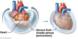 Serous fluid in pericardium