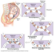 Erythroblastosis fetalis mechanism
