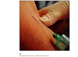 Venipuncture blood collection