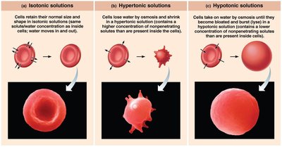 Effects of isotonic, hypertonic, and hypotonic solutions on cells