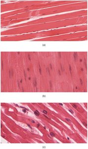 Histological images of skeletal, smooth, and cardiac muscle