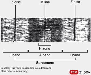 Electron micrograph of sarcomere showing bands and lines
