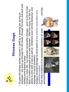 Phineas Gage case study