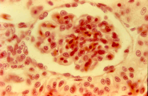 Simple squamous epithelium under microscope