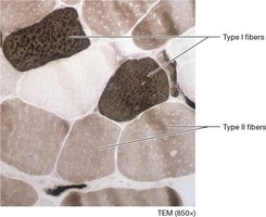 Muscle fiber types TEM