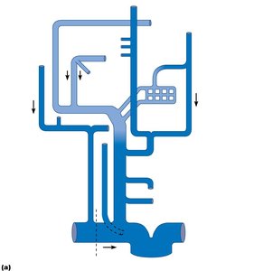 Venous drainage of the head, neck, and brain (schematic)