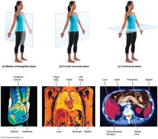 Body planes and MRI scans