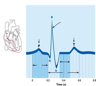 ECG showing P wave, QRS complex, and T wave