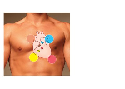 Locations for auscultation of heart valve sounds