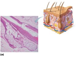 Photomicrograph of sebaceous gland