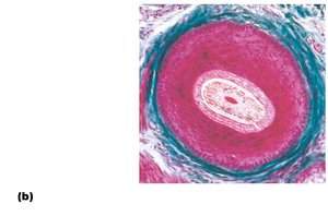 Photomicrograph of hair and hair follicle cross section