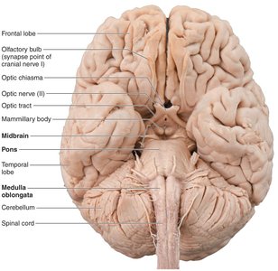 Ventral view of the brain showing the three parts of the brain stem