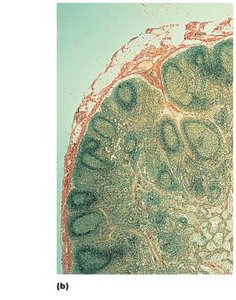 Photomicrograph of a lymph node