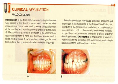 Malocclusion clinical application