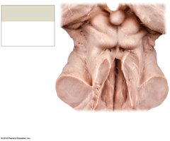 Cadaver dissection of the midbrain
