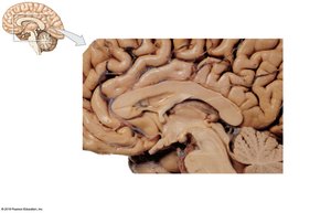 Sagittal section showing the hypothalamus