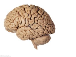 Lateral view of the brain showing lobes and sulci