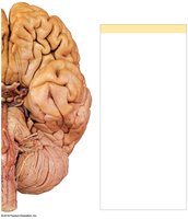 Origins of cranial nerves, part 2