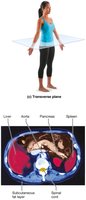 Transverse plane with MRI scan