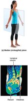 Posterior regional terms