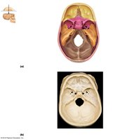 Sphenoid bone with lesser and greater wings and sella turcica
