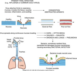 Pathogenesis of viral respiratory infection and secondary bacterial infection