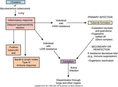 Pathogenesis of tuberculosis: primary and secondary infection
