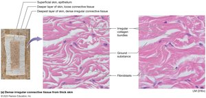 Dense irregular connective tissue