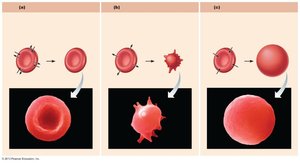 Effect of isotonic, hypertonic, and hypotonic solutions on red blood cells