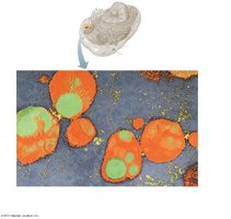 Electron micrograph of lysosomes