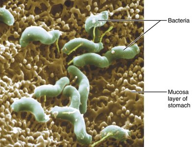 Photomicrograph of H. pylori bacteria