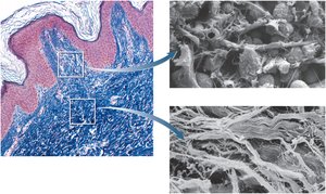 Histological and electron micrograph images of dermal layers