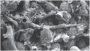 Papillary layer of dermis electron micrograph