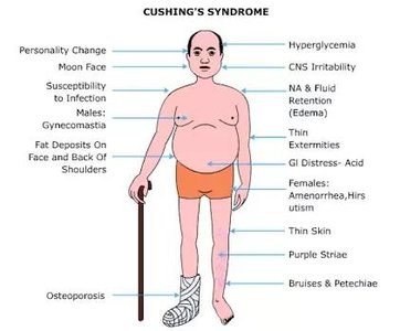 Symptoms of Cushing's syndrome
