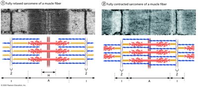 Changes in striations as skeletal muscle contracts
