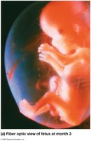 Fiber optic view of fetus at month 3