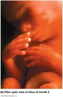 Fiber optic view of fetus at month 5