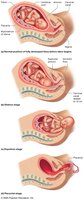 The stages of labor
